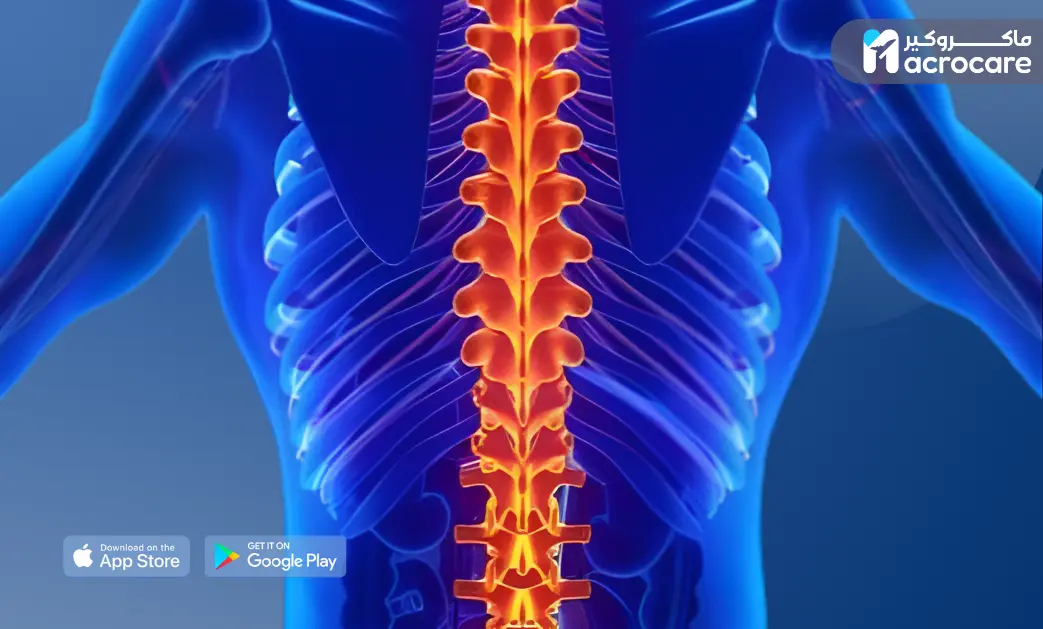 Spinal Fusion Surgery A Comprehensive Medical Tourism Guide for Advanced Spine Care in Egypt cover image