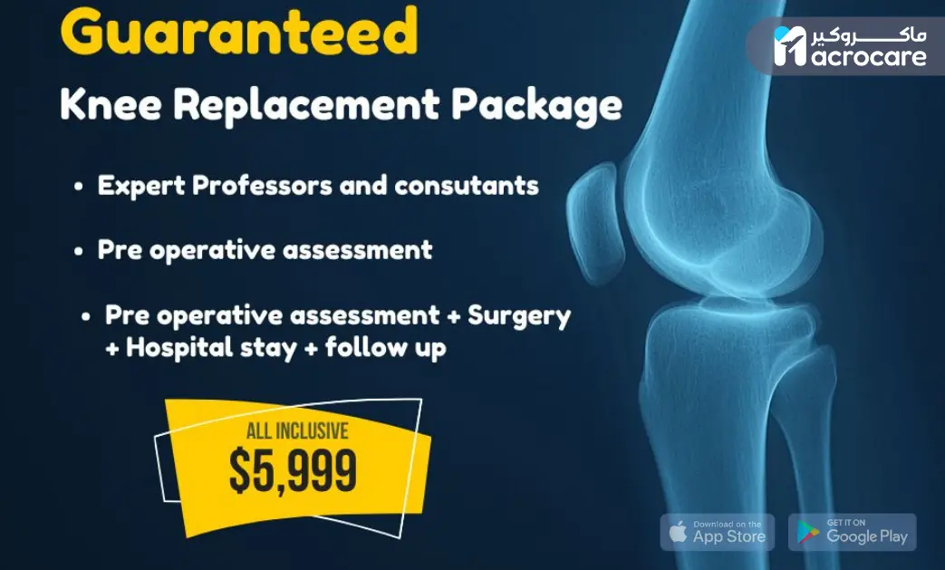 Your Complete Knee Replacement Journey with Macrocare – From First Step to Confident Recovery cover image