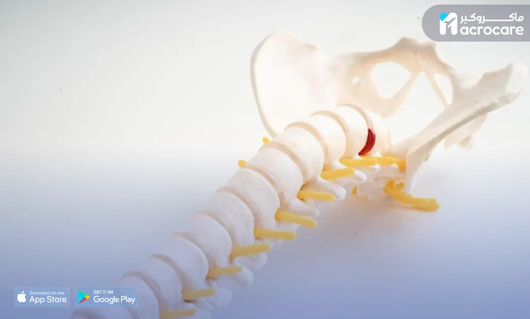 Advanced Neurosurgery and Spine Surgery in Egypt with Macrocare cover image