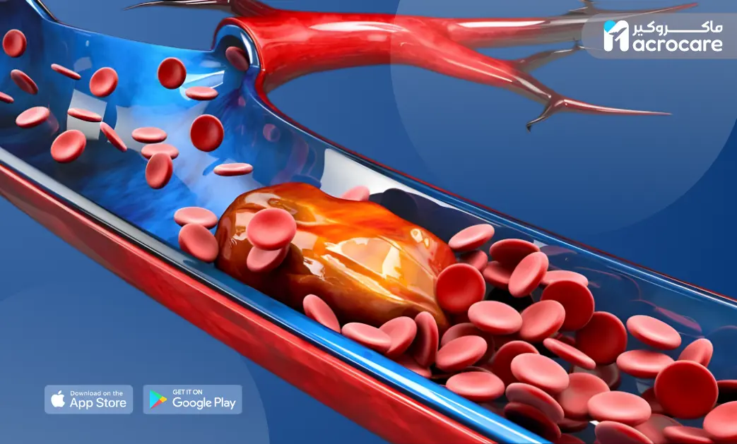Early Signs of Blood Clots: When Your Body Warns You Before It’s Too Late cover image