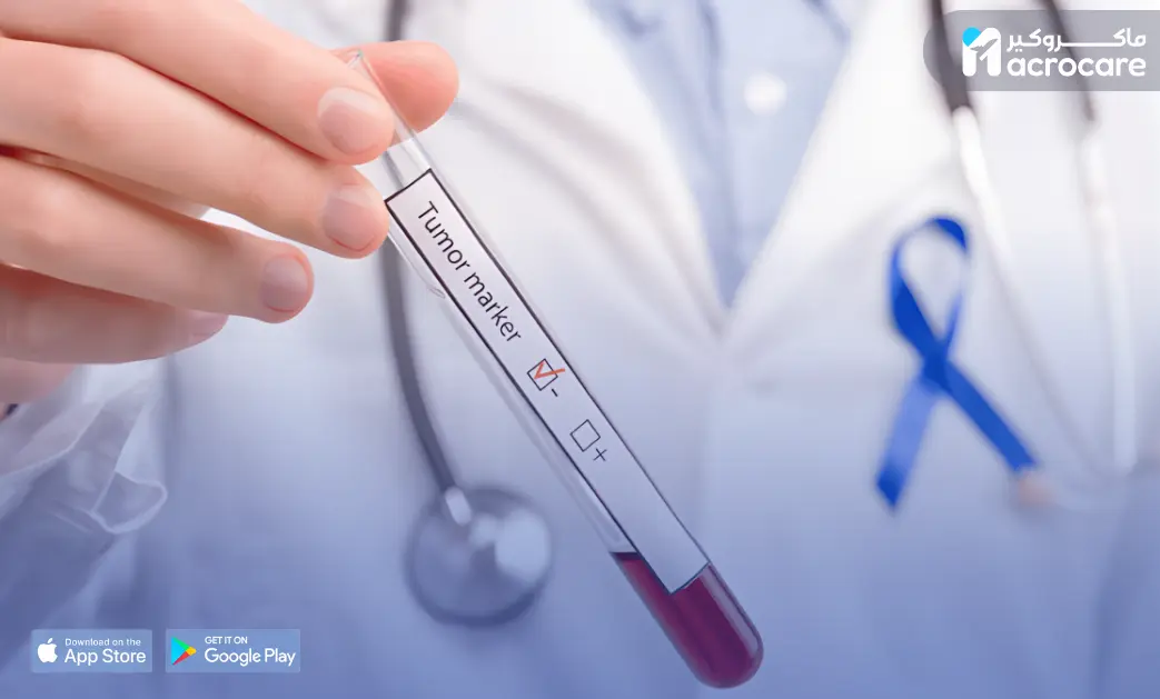 Early Tumor Detection: A Life-Saving Step with Macrocare cover image