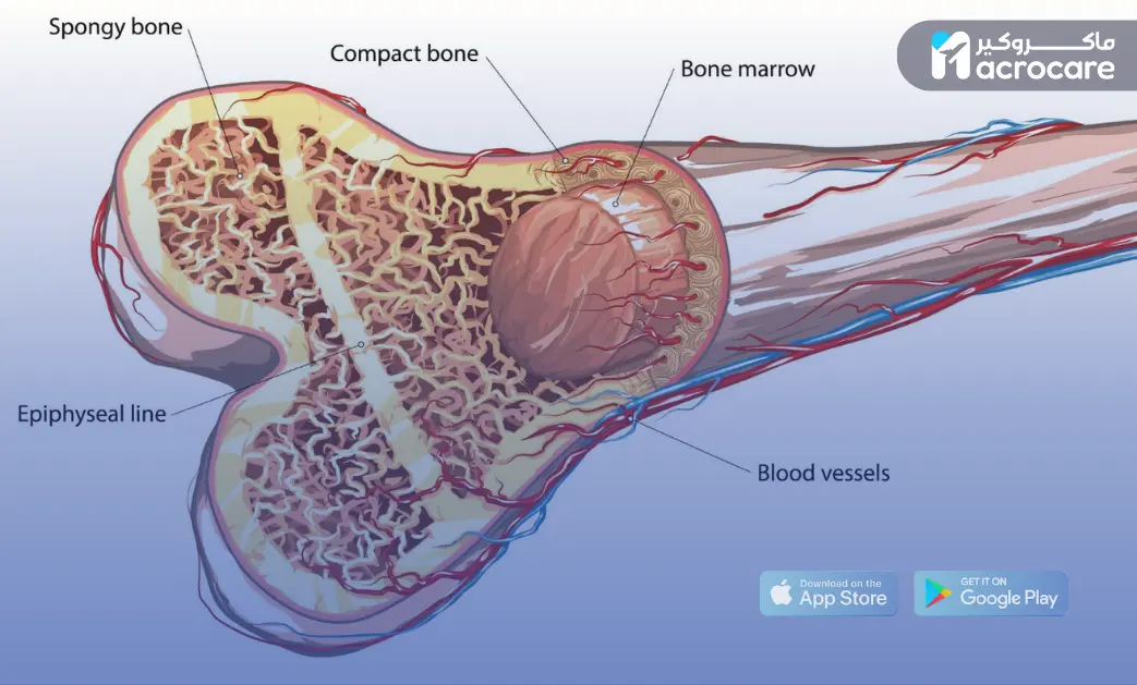 Bone Marrow Transplantation in Egypt: Procedures, Indications, and the Role of Macrocare in the Treatment Journey cover image