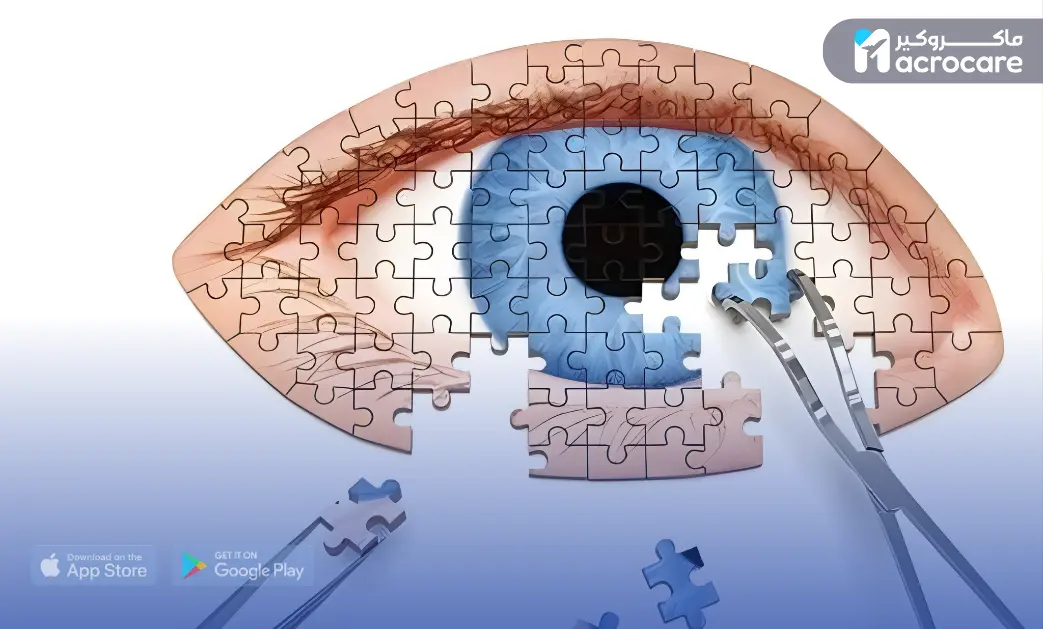 Clear Vision, Confident Care With Macrocare cover image