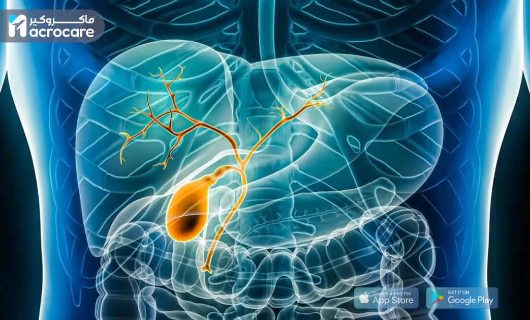 Pancreaticoduodenectomy (Whipple Procedure) cover image