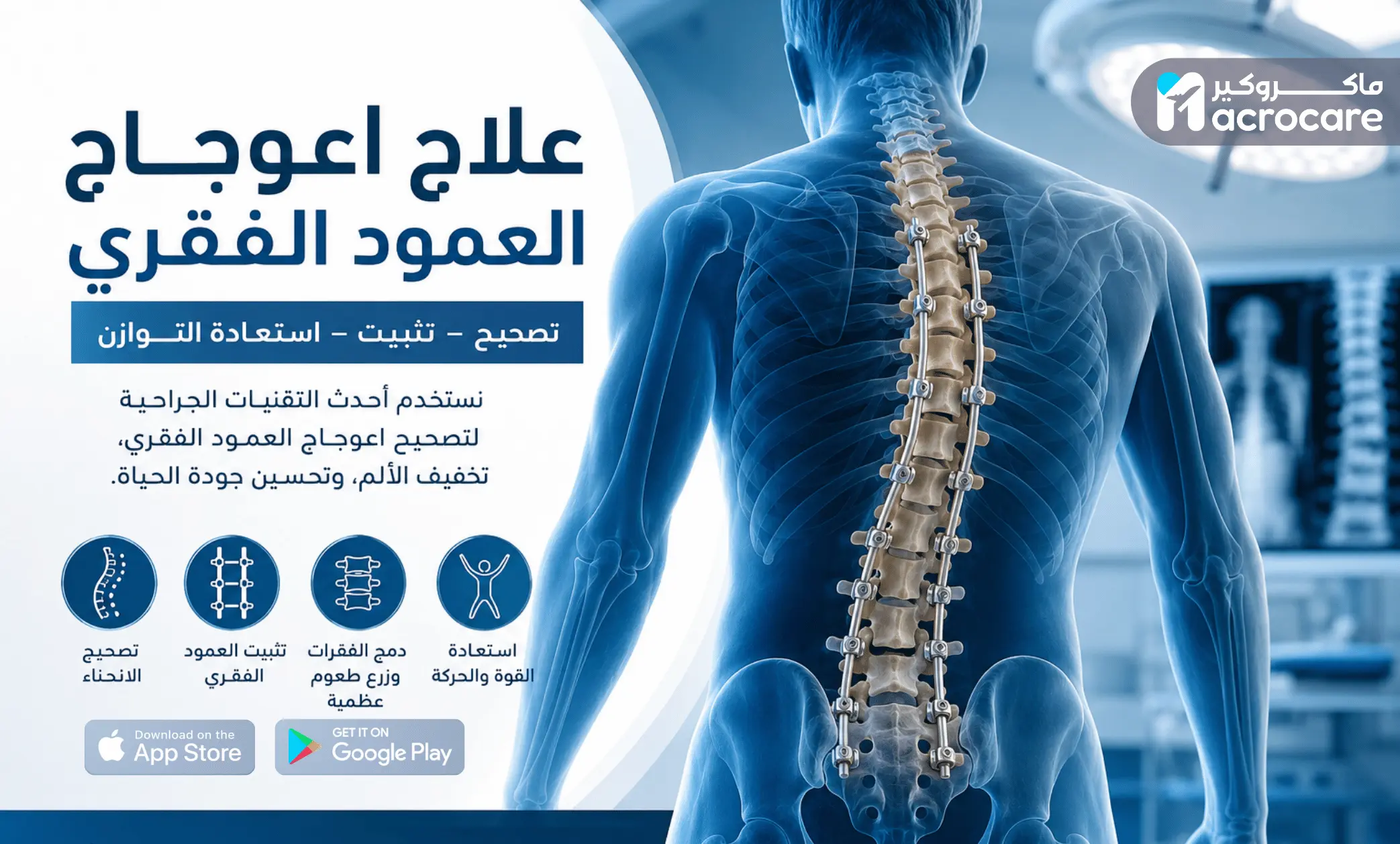 دليل ماكروكير لعلاج اعوجاج العمود الفقري: من التشخيص حتى التعافي thumbnail