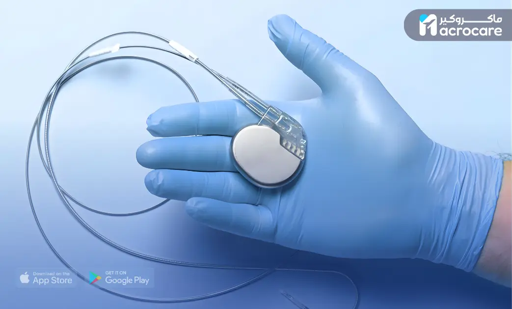Pacemaker Implantation in Egypt: A Complete Medical Journey with Macrocare cover image